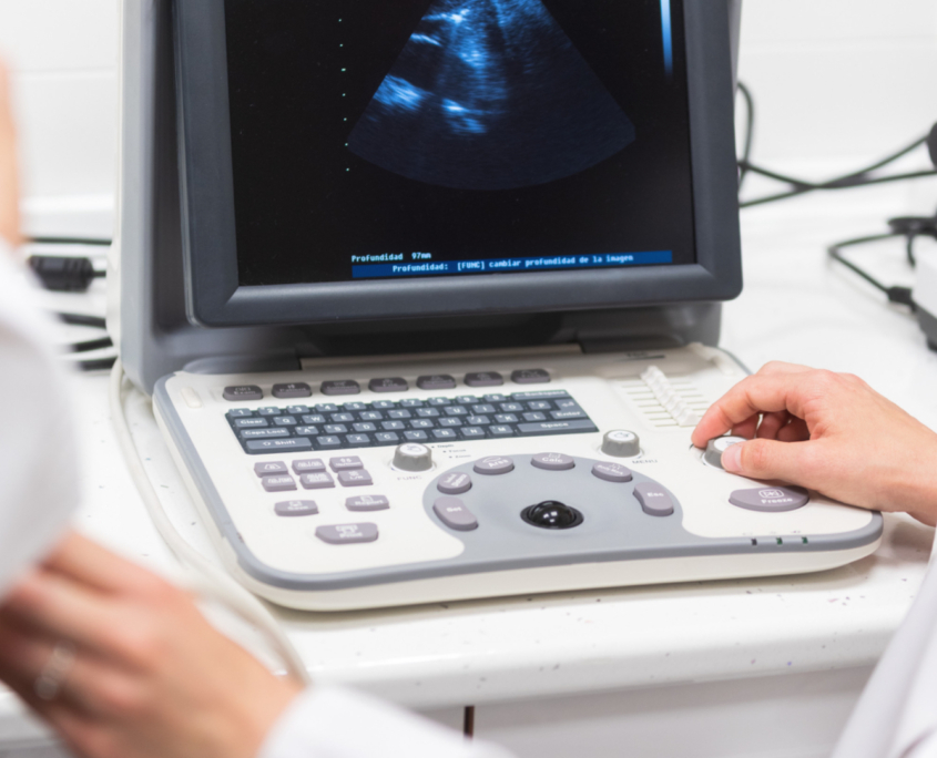 Cardiac Ultrasound
